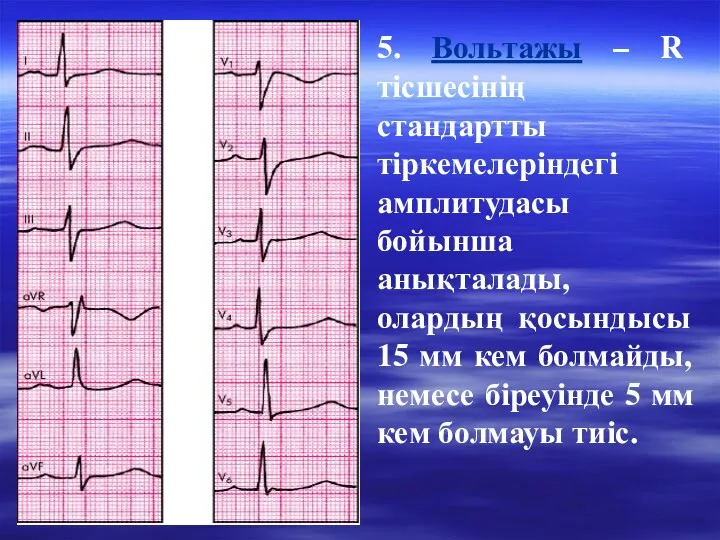 5. Вольтажы – R тісшесінің стандартты тіркемелеріндегі амплитудасы бойынша анықталады,