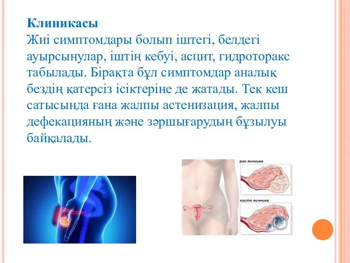 Клиникасы Жиі симптомдары болып іштегі, белдегі ауырсынулар, іштің кебуі, асцит,