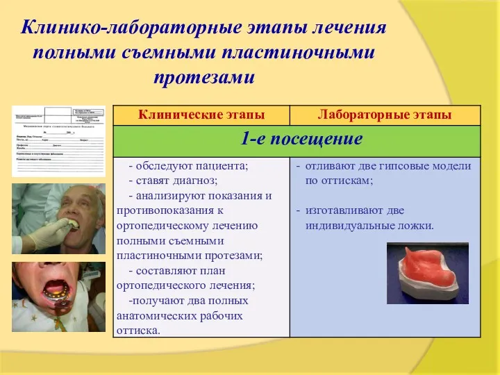 Клинико-лабораторные этапы лечения полными съемными пластиночными протезами