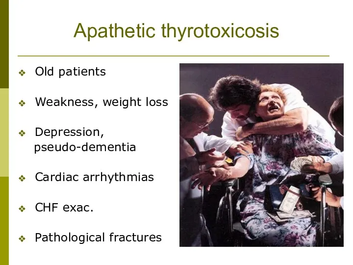 Apathetic thyrotoxicosis Old patients Weakness, weight loss Depression, pseudo-dementia Cardiac arrhythmias CHF exac. Pathological fractures