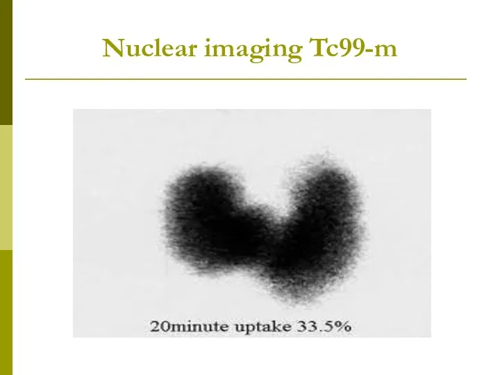 Nuclear imaging Tc99-m