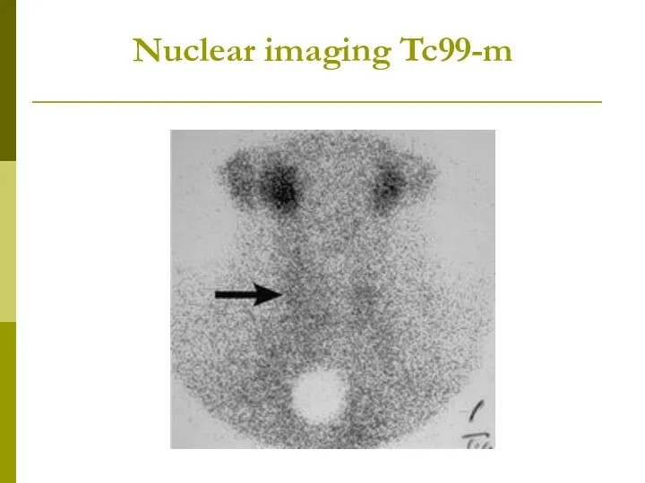 Nuclear imaging Tc99-m