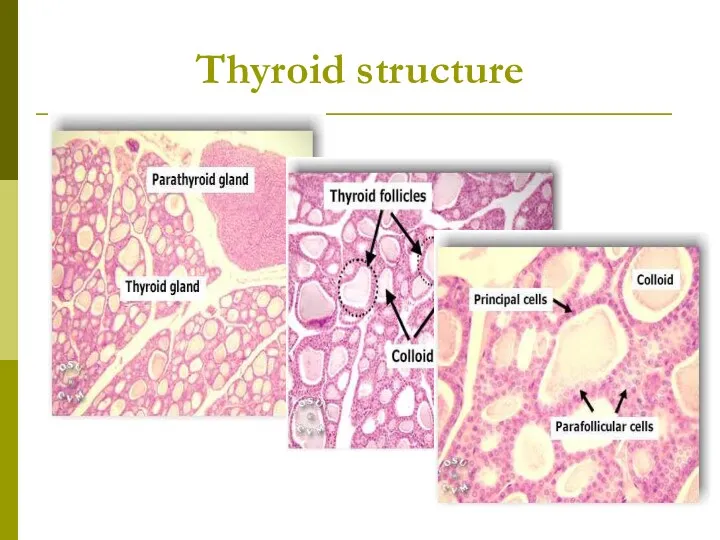 Thyroid structure