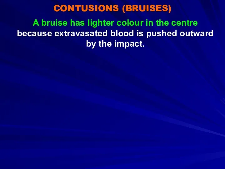 CONTUSIONS (BRUISES) A bruise has lighter colour in the centre