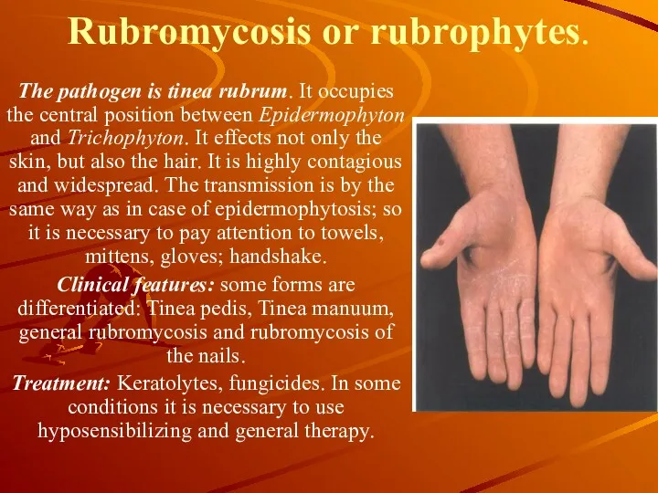 Rubromycosis or rubrophytes. The pathogen is tinea rubrum. It occupies