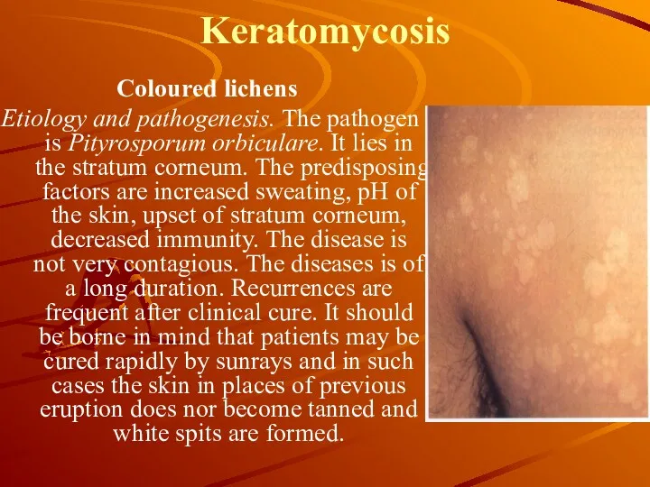 Keratomycosis Coloured lichens Etiology and pathogenesis. The pathogen is Pityrosporum
