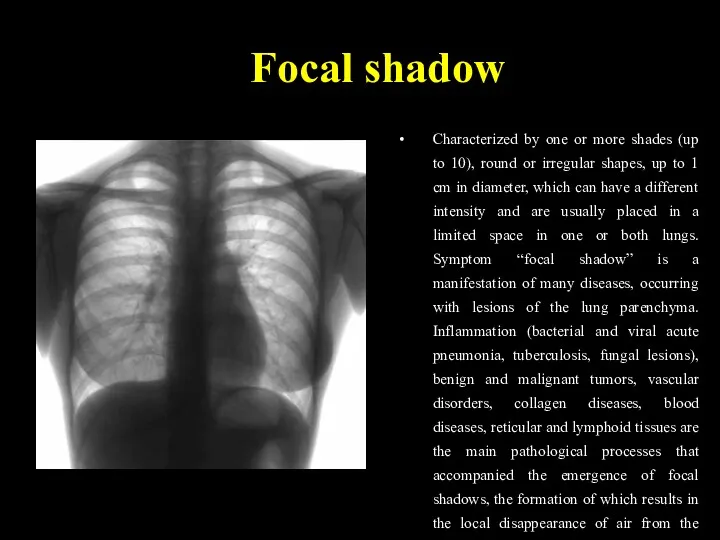 Focal shadow Characterized by one or more shades (up to