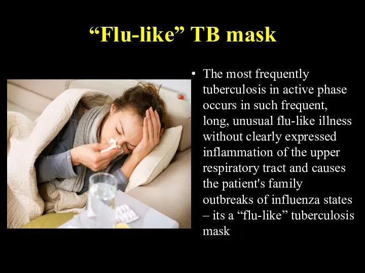 “Flu-like” TB mask The most frequently tuberculosis in active phase