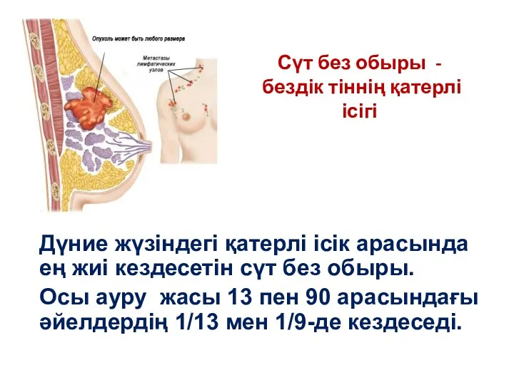 Дүние жүзіндегі қатерлі ісік арасында ең жиі кездесетін сүт без