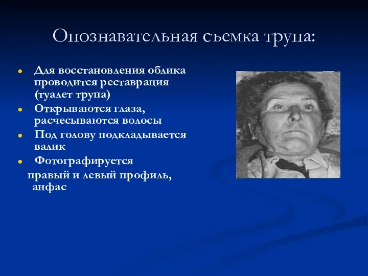 Опознавательная съемка трупа: Для восстановления облика проводится реставрация (туалет трупа)