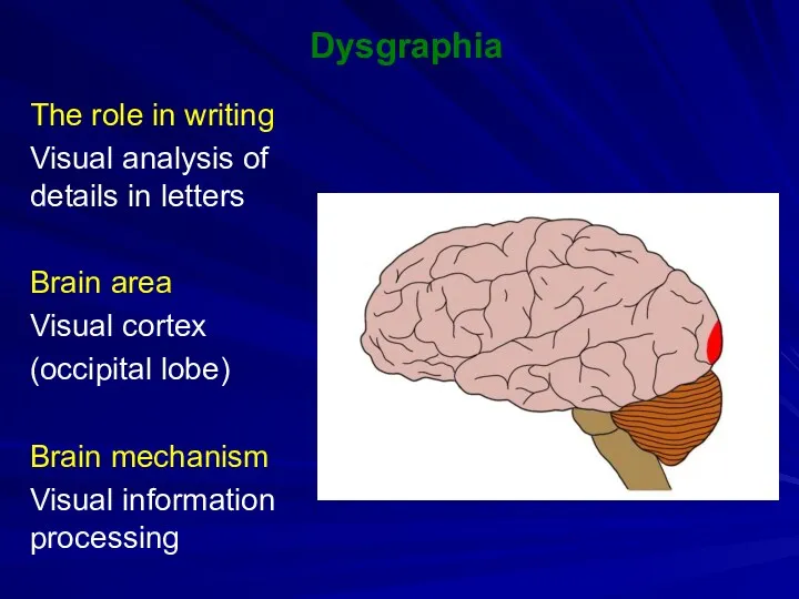 Dysgraphia The role in writing Visual analysis of details in letters Brain area