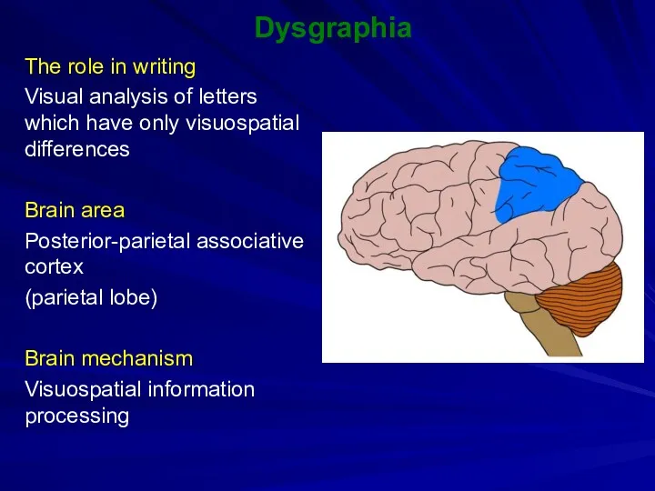 Dysgraphia The role in writing Visual analysis of letters which have only visuospatial