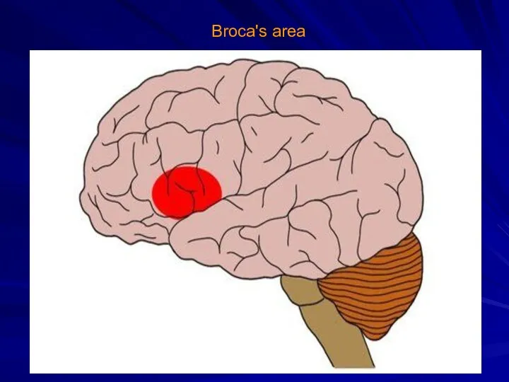 Broca's area