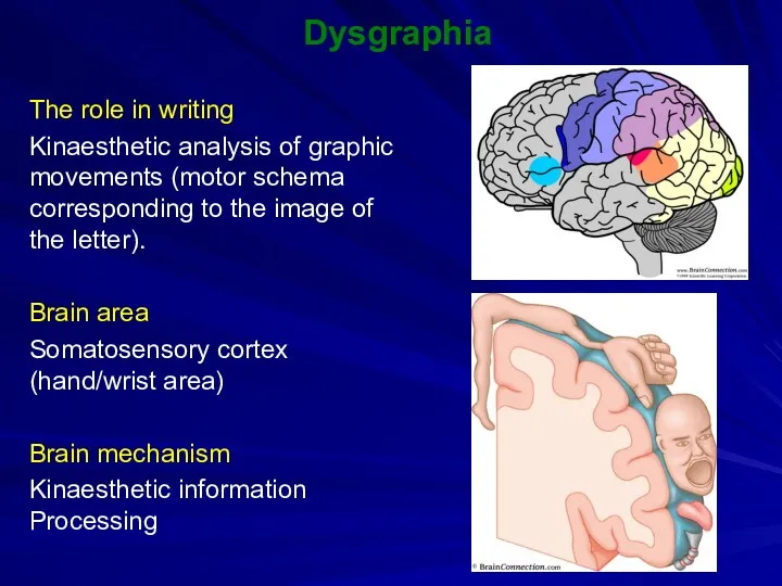 Dysgraphia The role in writing Kinaesthetic analysis of graphic movements (motor schema corresponding