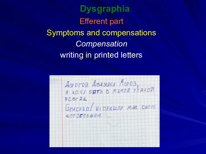 Dysgraphia Efferent part Symptoms and compensations Compensation writing in printed letters