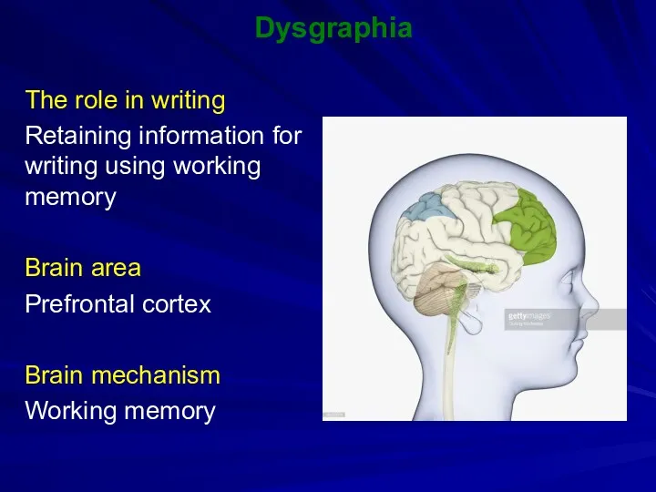Dysgraphia The role in writing Retaining information for writing using working memory Brain