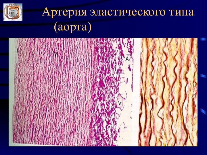 Артерия эластического типа (аорта)