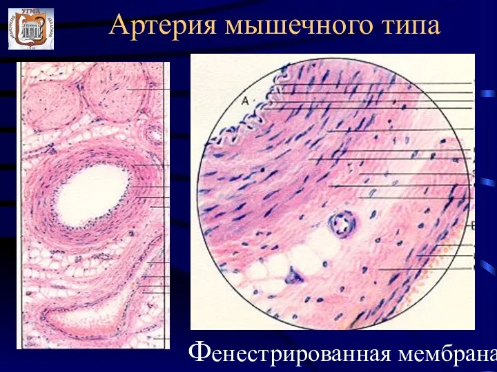 Артерия мышечного типа Фенестрированная мембрана