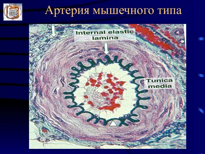 Артерия мышечного типа