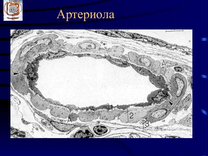 Артериола