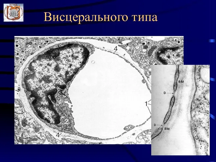 Висцерального типа