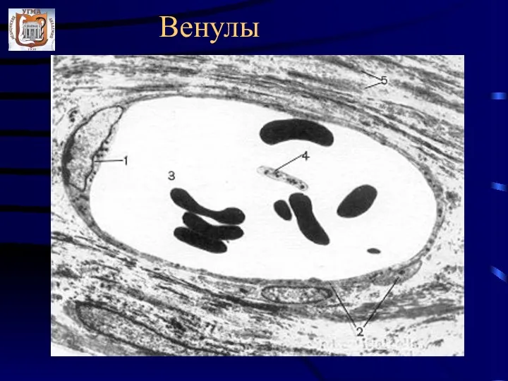 Венулы