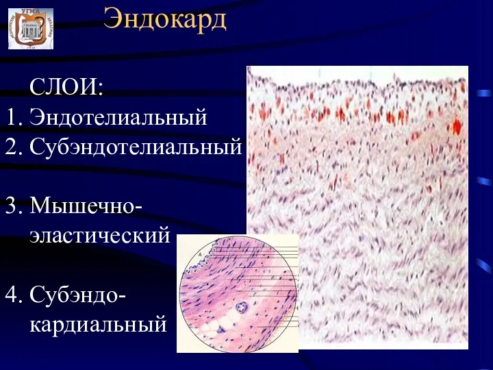 Эндокард СЛОИ: 1. Эндотелиальный 2. Субэндотелиальный 3. Мышечно- эластический 4. Субэндо- кардиальный