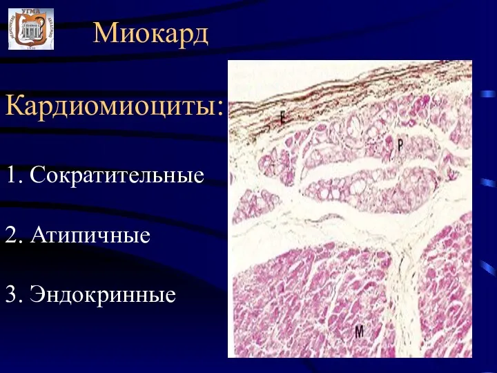 Миокард Кардиомиоциты: 1. Сократительные 2. Атипичные 3. Эндокринные