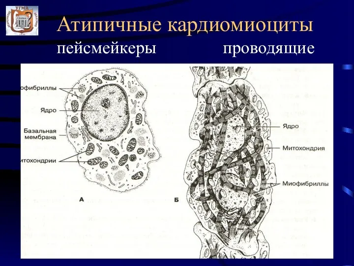 Атипичные кардиомиоциты пейсмейкеры проводящие