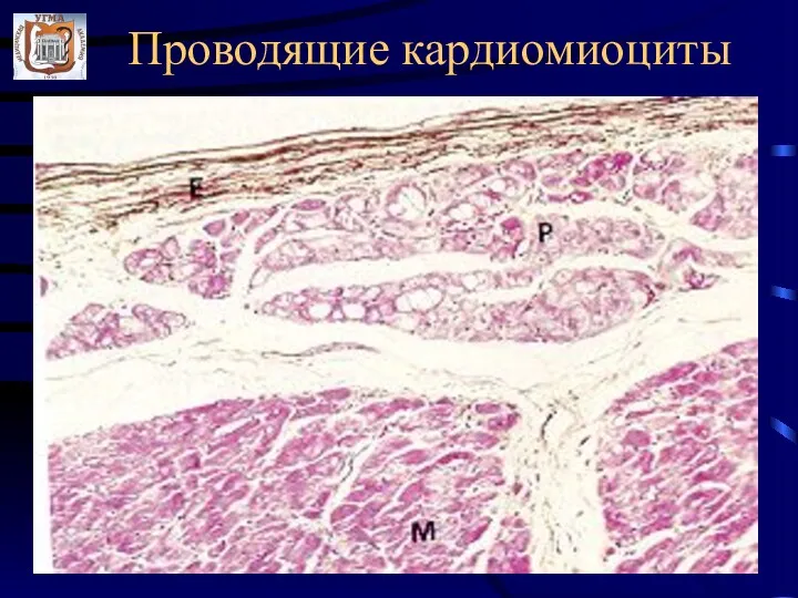 Проводящие кардиомиоциты