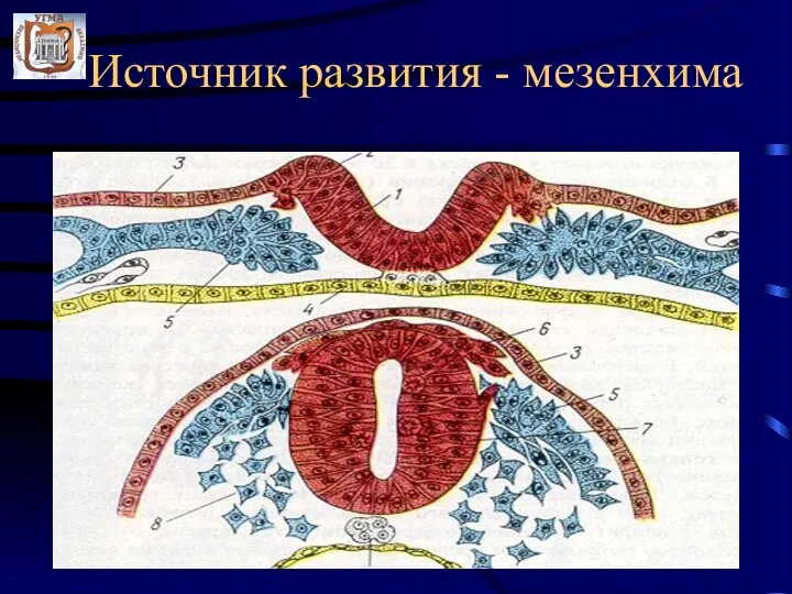 Источник развития - мезенхима