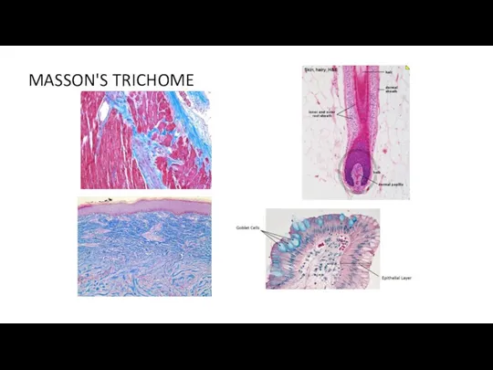 MASSON'S TRICHOME