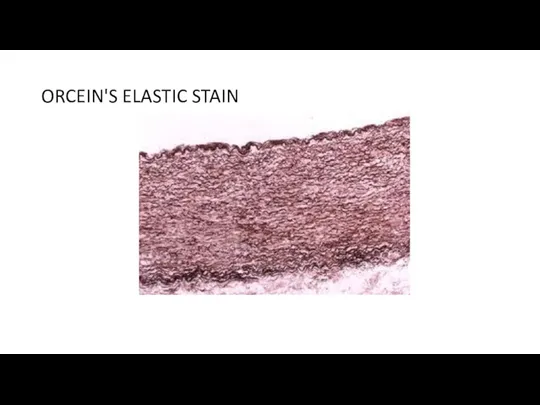 ORCEIN'S ELASTIC STAIN