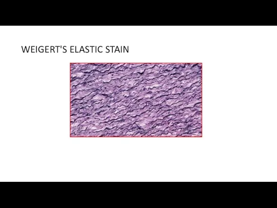 WEIGERT'S ELASTIC STAIN