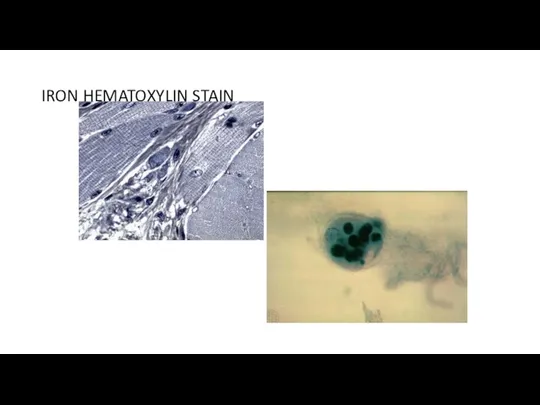 IRON HEMATOXYLIN STAIN