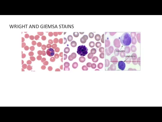 WRIGHT AND GIEMSA STAINS