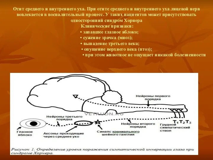 Отит среднего и внутреннего уха. При отите среднего и внутреннего