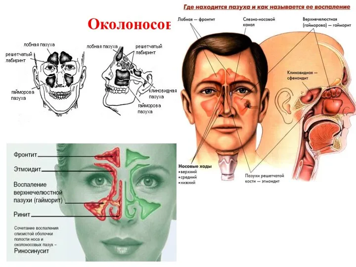 Околоносовые пазухи