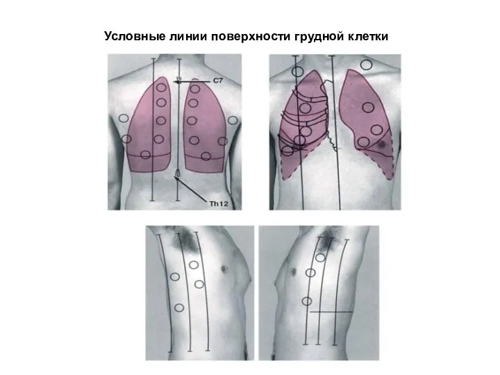 Условные линии поверхности грудной клетки