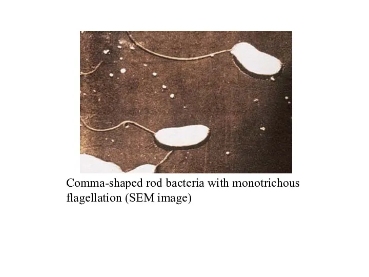 Comma-shaped rod bacteria with monotrichous flagellation (SEM image)