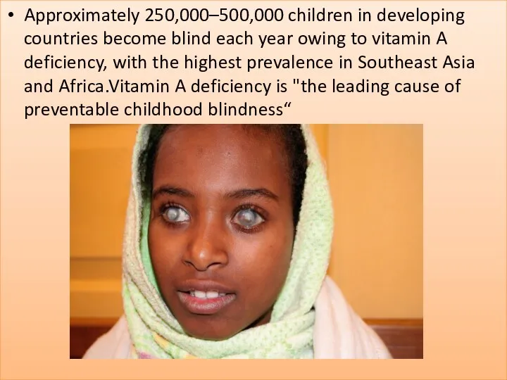 Approximately 250,000–500,000 children in developing countries become blind each year
