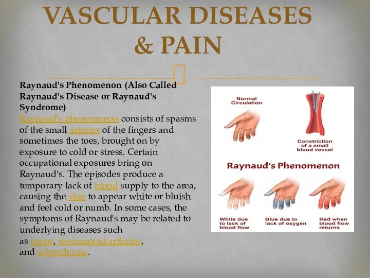 VASCULAR DISEASES & PAIN Raynaud's Phenomenon (Also Called Raynaud's Disease