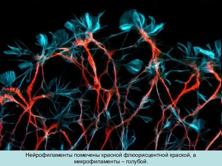 Нейрофиламенты помечены красной флюорисцентной краской, а микрофиламенты – голубой.