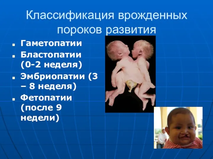 Классификация врожденных пороков развития Гаметопатии Бластопатии (0-2 неделя) Эмбриопатии (3 – 8 неделя)