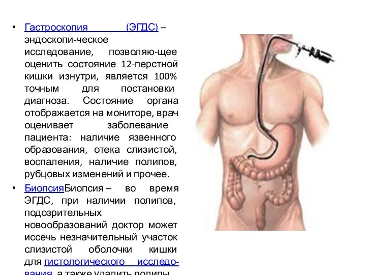 Гастроскопия (ЭГДС) – эндоскопи-ческое исследование, позволяю-щее оценить состояние 12-перстной кишки изнутри, является 100%