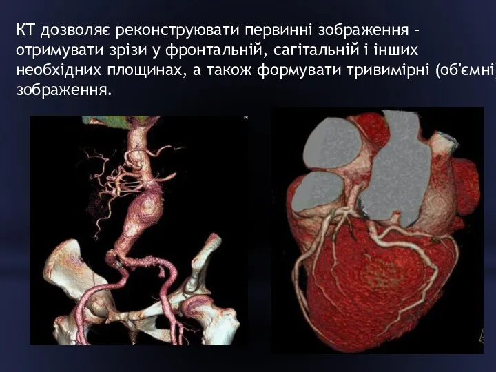 КТ дозволяє реконструювати первинні зображення - отримувати зрізи у фронтальній,