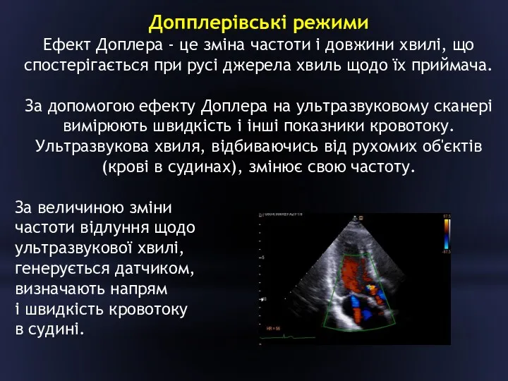 Допплерівські режими Ефект Доплера - це зміна частоти і довжини