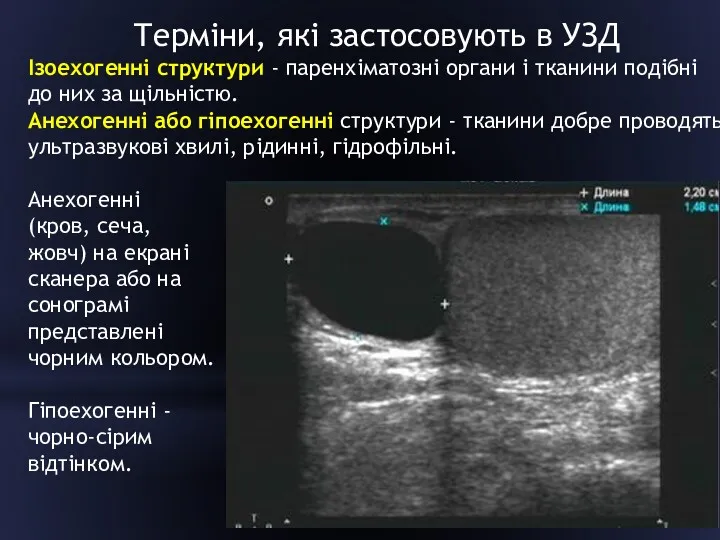 Терміни, які застосовують в УЗД Ізоехогенні структури - паренхіматозні органи