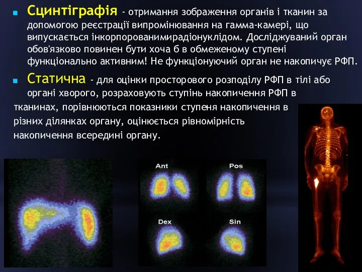 Сцинтіграфія - отримання зображення органів і тканин за допомогою реєстрації