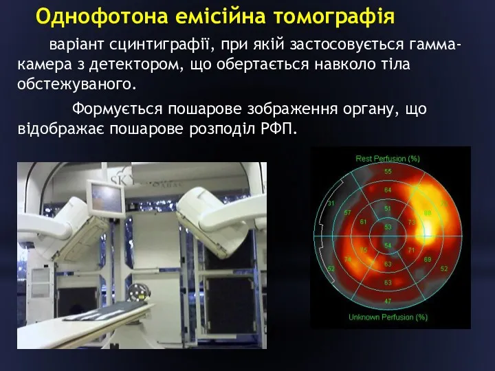 Однофотона емісійна томографія варіант сцинтиграфії, при якій застосовується гамма-камера з